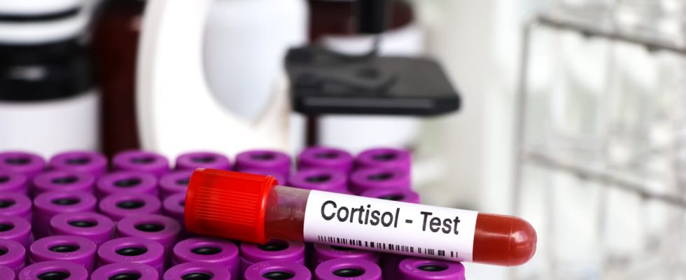 Why is cortisol called the stress hormone