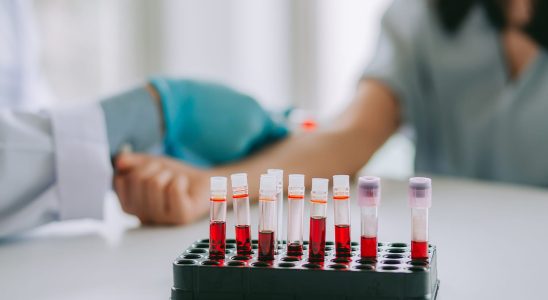 Blood test levels that can predict if you will live