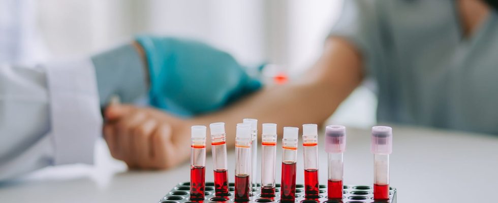 Blood test levels that can predict if you will live