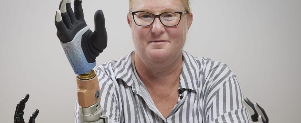 His new bionic hand directly connected to his arm gives