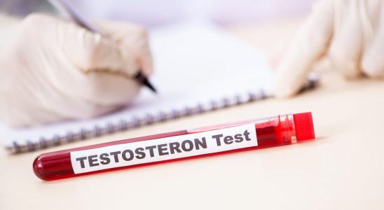 What is testosterone Definition role and normal rate