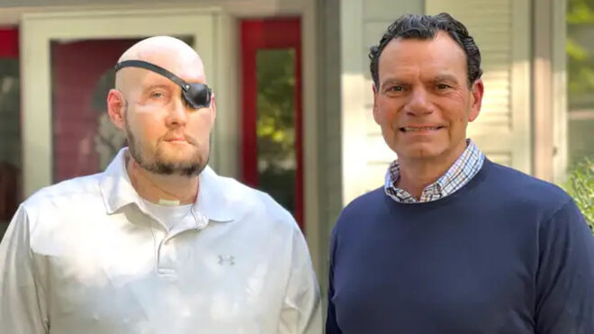 1699657858 425 Worlds first full eye transplant partially successful
