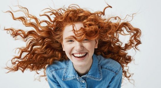 Redheads feel pain differently
