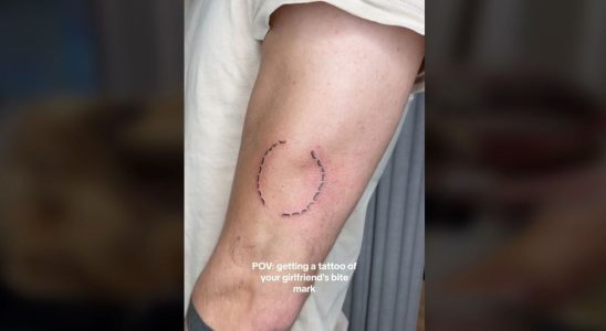 bitemarktattoo beware of this tattoo trend that is dangerous for