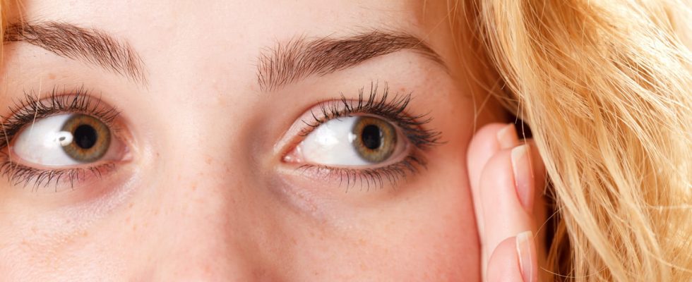 Cholesterol These signs in the eye show you have too