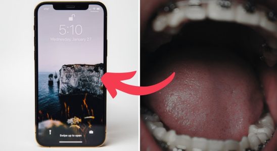 Control the phone with your tongue the new prototype