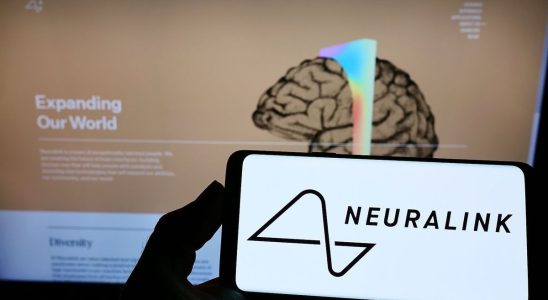Elon Musks company Neuralink has placed its first implant in