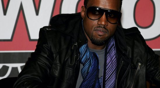 Kanye West gives himself an 800000 titanium smile with probable