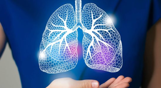 Sick lungs 3 worrying signs according to this pulmonologist