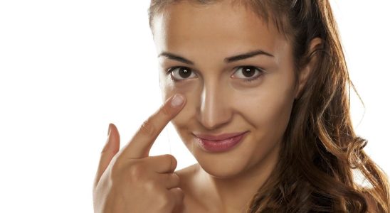 There are 4 types of dark circles according to our