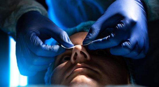 Aesthetic medicine the market slowed down in 2023 acceleration in