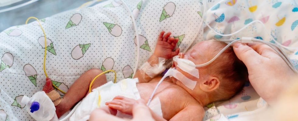 United States one in ten premature births are linked to
