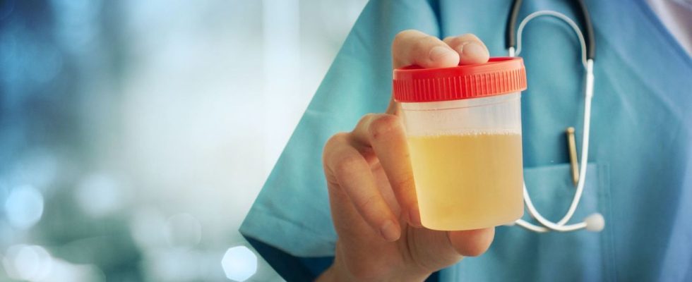 We finally know why urine is yellow