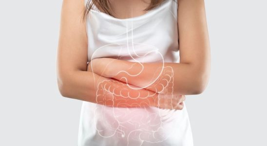 Crohns disease treating strongly from diagnosis could reduce complications