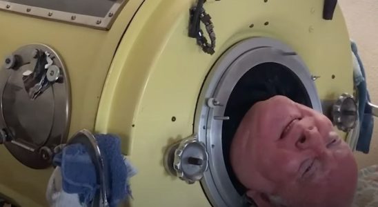 He lived in an iron lung for 72 years discover