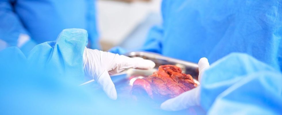 World first a genetically modified pig kidney was transplanted into