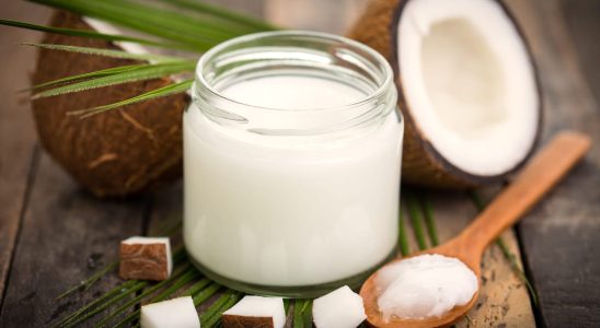 Does whitening your teeth with coconut oil really work