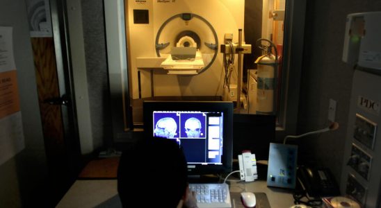 Iseult the most powerful MRI in the world delivers its