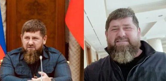 Kadyrovs condition worsened living death