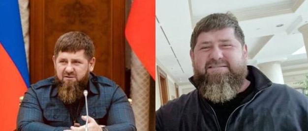 Kadyrovs condition worsened living death