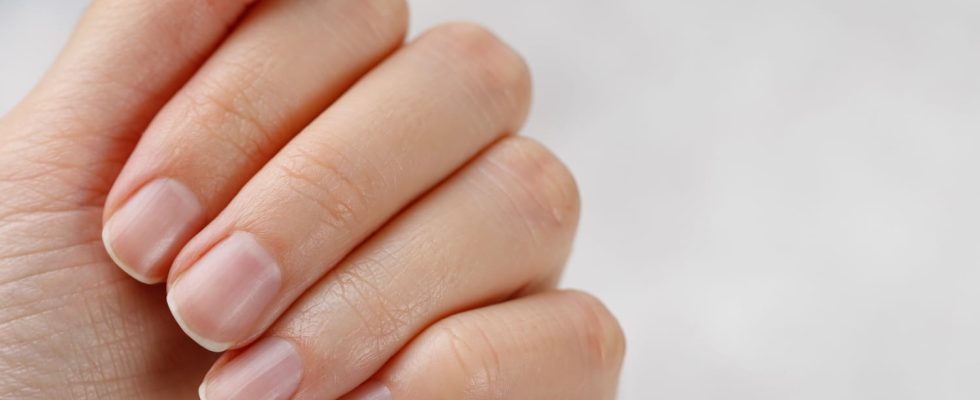 Little known this sign on the nails can reveal a