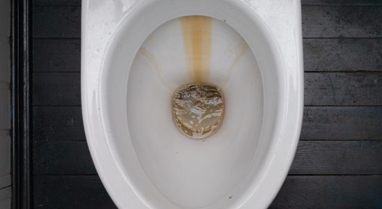 This is THE solution to avoid limescale in the toilet