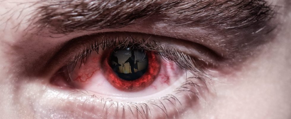 We finally know why you may have red eyes in