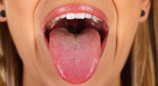 Your mouth is giving a signal Pay attention to these