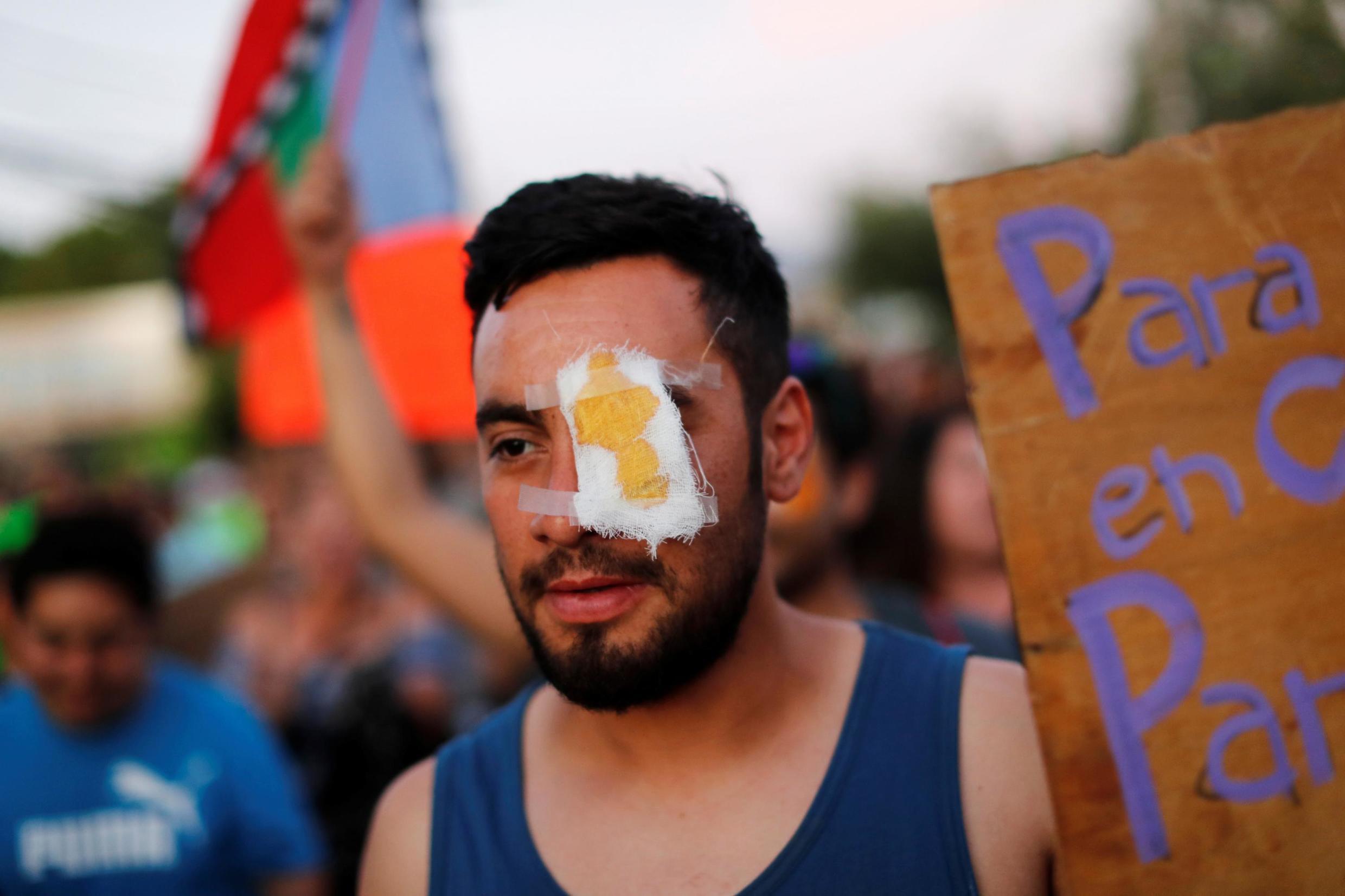 La Colina, Chile, November 10, 2019: a protester wears an eyepatch in solidarity with Gustavo Gatica, a student who lost his sight completely after being injured by police shooting on November 8, 2019 during of a demonstration in Santiago,