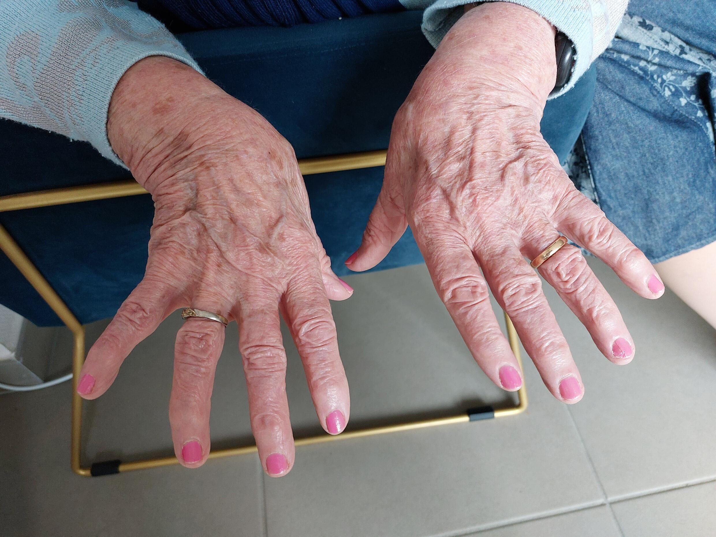 Before joining the house, Odette, a former farmer, had never painted her nails.  “But the attendants at the house take great care,” laughs the nonagenarian.