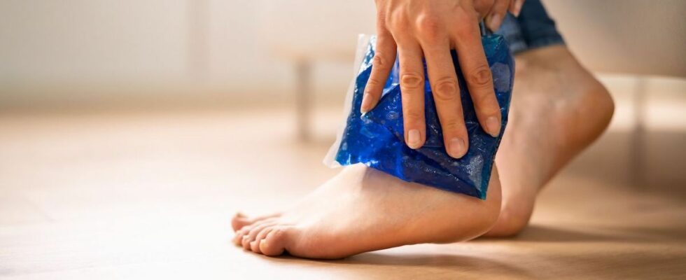 Applying ice in case of sprain tendonitis is called into