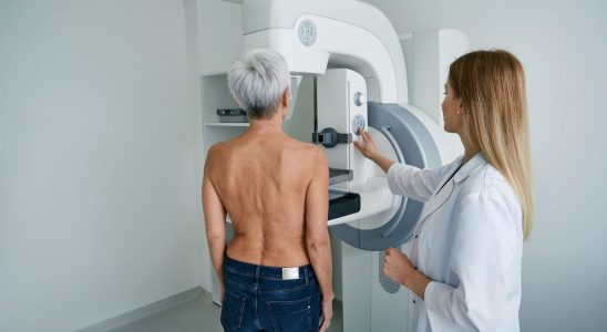 Breast cancer screening on the decline among women aged 50