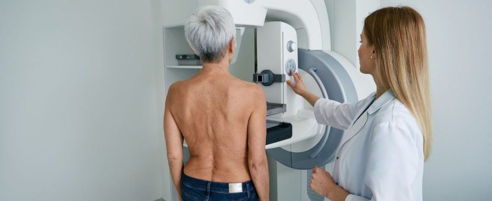 Breast cancer screening on the decline among women aged 50
