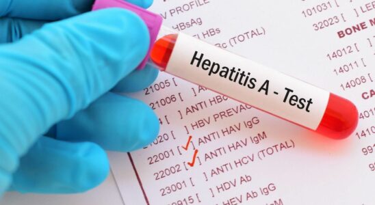 Several cases of hepatitis A contamination in the city of