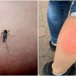 The mosquito repellent you shouldnt use this summer Illegal to
