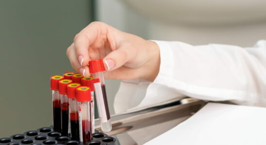 Cancer what is liquid biopsy Where to do it