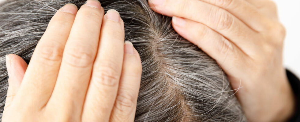Heres What to Eat to Prevent Gray Hair