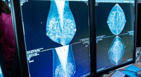 Invite older women to mammography