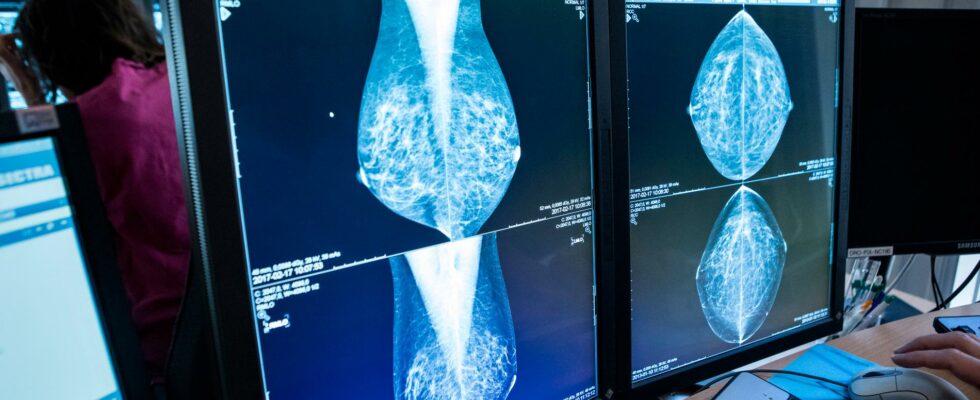 Invite older women to mammography