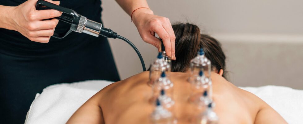 Is cupping therapy beneficial Why Brut backpedaled – LExpress