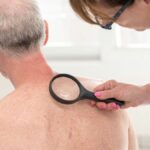 Skin cancers technology and AI for better screening