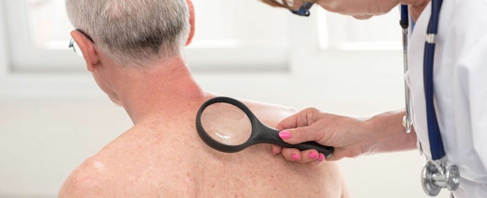 Skin cancers technology and AI for better screening