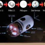 Thanks to the swallowable Pillbot endoscopy can be performed remotely