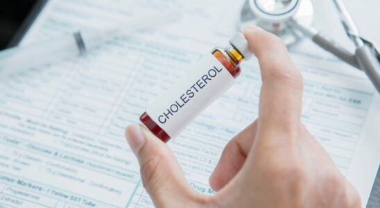 Cholesterol level not to be exceeded after 60 years