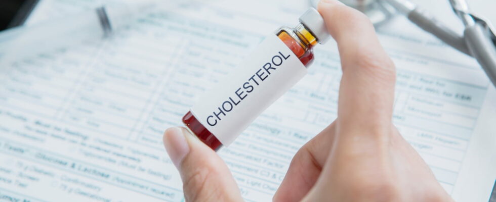 Cholesterol level not to be exceeded after 60 years