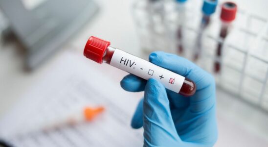 HIV Seventh case of probable cure after bone marrow transplant