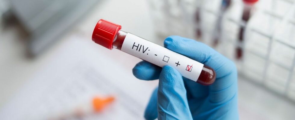 HIV Seventh case of probable cure after bone marrow transplant