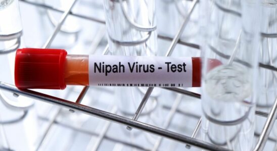 Nipah virus in India Is there a real risk of