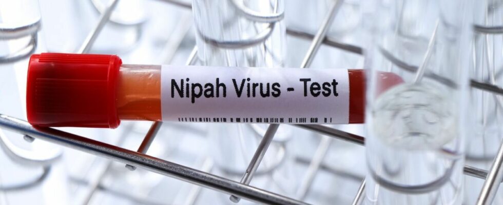 Nipah virus in India Is there a real risk of