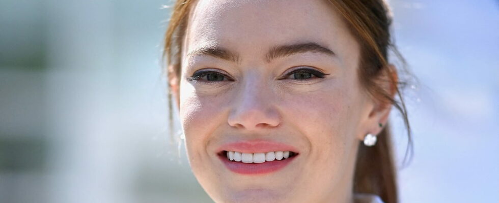 With her ultra puffed lips and XXL bob Emma Stone is